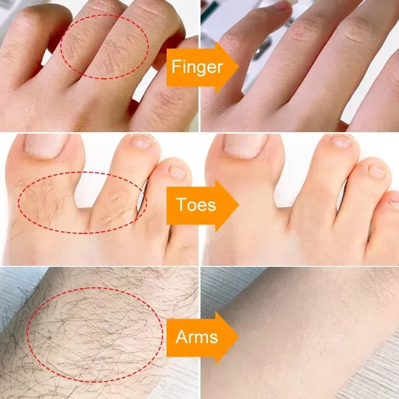 Hair Removal Cream