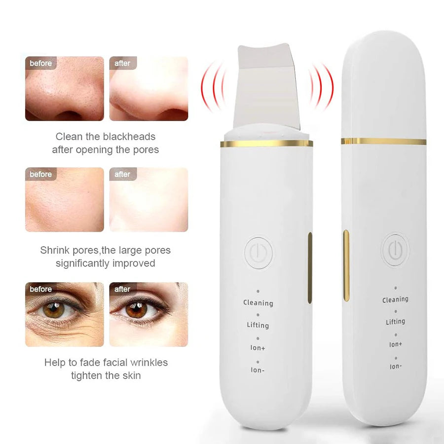 Ultrasonic skin scub