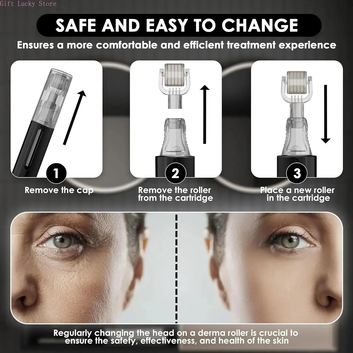 Derma Roller