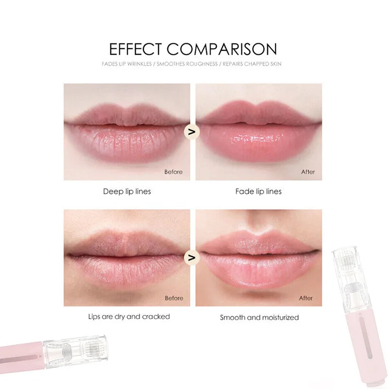 Women Facial Lip Derma Roller